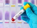 Ręka w niebieskiej rękawiczce trzyma probówkę z napisem "IGF-1 Test" na tle szkiełek laboratoryjnych.