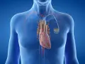 Anatomical illustration of a human heart with a pacemaker. Zastanawiasz się, ile się czeka na wszczepienie rozrusznika serca?