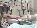 Ramię pacjenta podłączone do aparatury dializacyjnej.