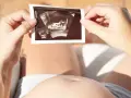 Kobieta trzyma w dłoniach zdjęcie USG płodu na tle swojego brzucha.