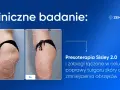 Porównanie sylwetki przed i po presoterapii, ukazujące redukcję obrzęków i poprawę napięcia skóry.