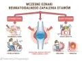 Ilustracja przedstawia schemat wczesnych oznak reumatoidalnego zapalenia stawów, z zaznaczonym stawem kolanowym i objawami.