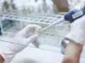 Badacz w rękawiczkach pobiera próbkę do badań nad nowoczesnym leczeniem osteoporozy.