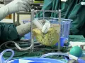 Chirurg przygotowuje sztuczne serce do wszczepienia. Urządzenie jest zamontowane na stelażu, otoczone narzędziami i materiałami medycznymi.