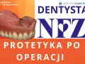Proteza zębowa na pomarańczowym tle z napisem NFZ i "Protetyka po operacji".
