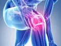 Anatomical illustration of a knee joint with highlighted areas of pain in pink.