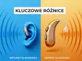 Grafika porównująca implant ślimakowy w uchu z aparatem słuchowym.