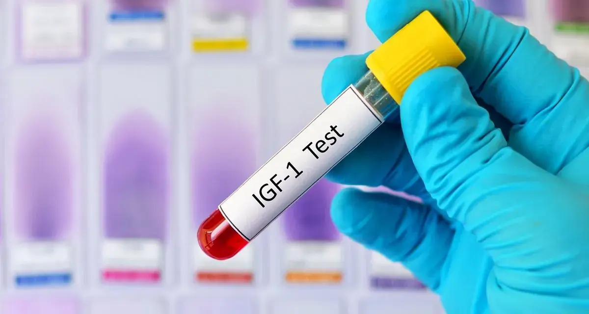 Ręka w niebieskiej rękawiczce trzyma probówkę z napisem "IGF-1 Test" na tle szkiełek laboratoryjnych.