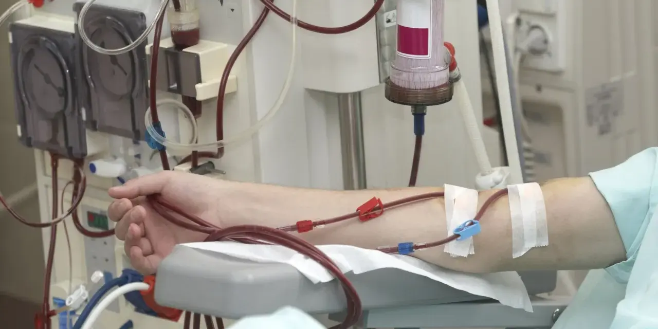 Ramię pacjenta podłączone do aparatury dializacyjnej.