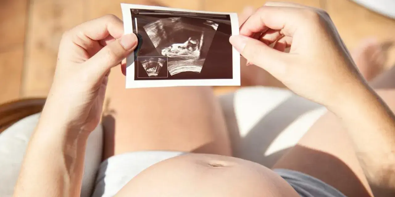 Kobieta trzyma w dłoniach zdjęcie USG płodu na tle swojego brzucha.