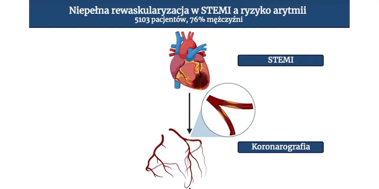 Ilustracja przedstawia serce, naczynia wieńcowe i schemat koronarografii.