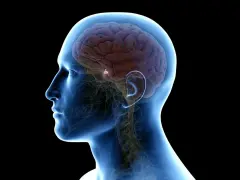 Anatomia mózgu z zaznaczonym guzem przysadki mózgowej. Choć rzadko, guz przysadki mózgowej może prowadzić do poważnych konsekwencji, a nawet śmiertelności.