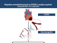 Ilustracja przedstawia serce, naczynia wieńcowe i schemat koronarografii.