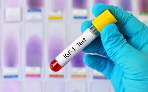Ręka w niebieskiej rękawiczce trzyma probówkę z napisem "IGF-1 Test" na tle szkiełek laboratoryjnych.