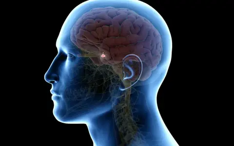 Anatomia mózgu z zaznaczonym guzem przysadki mózgowej. Choć rzadko, guz przysadki mózgowej może prowadzić do poważnych konsekwencji, a nawet śmiertelności.