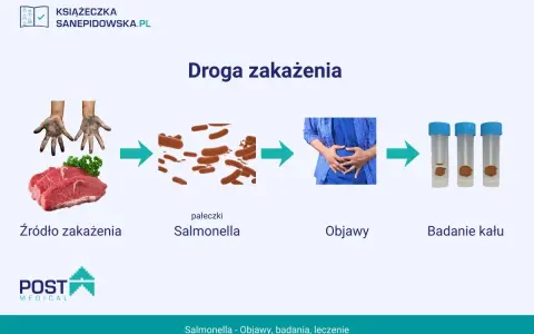 Droga zakażenia Salmonellą: od surowego mięsa i brudnych rąk, przez pałeczki, do objawów bólu brzucha i badania kału.