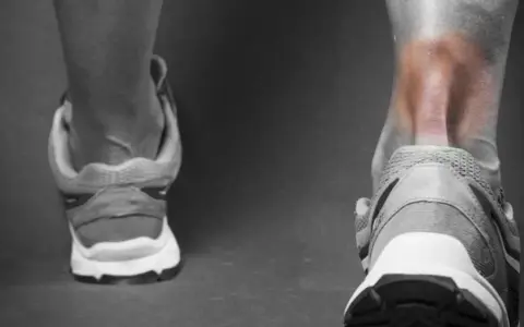 Ból w pięcie i łydce sugeruje zapalenie ścięgna Achillesa. Widok z tyłu na nogę w bucie sportowym, z zaczerwienionym obszarem.