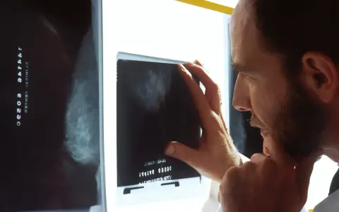 Lekarz analizuje mammografię, szukając oznak raka.