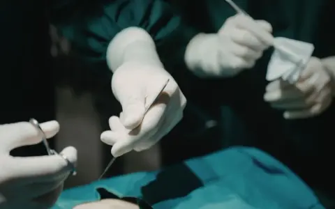 Dłonie chirurga w rękawiczkach trzymające narzędzia chirurgiczne i gazę podczas operacji.