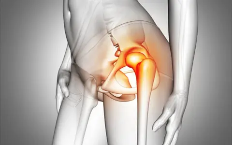 Anatomical illustration of a human pelvis with the hip joint highlighted in red, indicating pain.