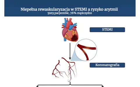 Ilustracja przedstawia serce, naczynia wieńcowe i schemat koronarografii.