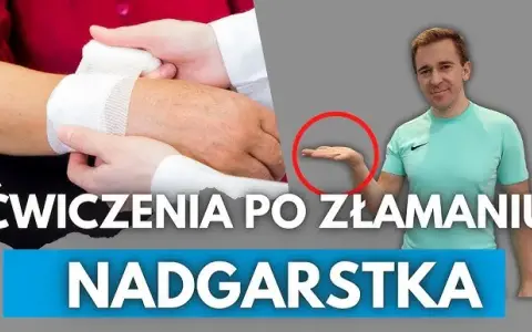 Ile trwa rehabilitacja po złamaniu nadgarstka? Poznaj szczegóły procesu