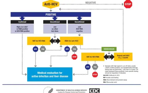 Schemat diagnostyki zakażenia HCV. Analizuje wyniki testów Anti-HCV, NAT, RIBA, by ocenić zapalenie wątroby typu C objawy.