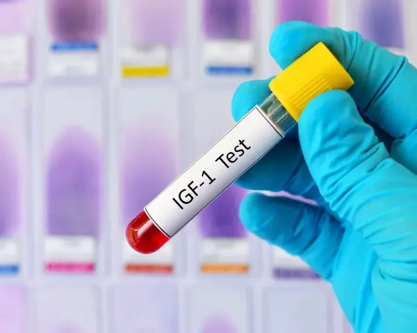 Ręka w niebieskiej rękawiczce trzyma probówkę z napisem "IGF-1 Test" na tle szkiełek laboratoryjnych.