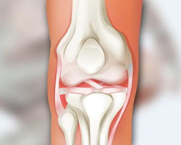 Anatomia ludzkiego kolana z widocznymi kośćmi, więzadłami i chrząstkami.