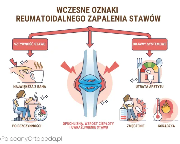 Ilustracja przedstawia schemat wczesnych oznak reumatoidalnego zapalenia stawów, z zaznaczonym stawem kolanowym i objawami.