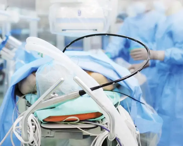 Pacjent na stole operacyjnym, przygotowany do zabiegu PCI kardiologia. W tle personel medyczny w niebieskich fartuchach.