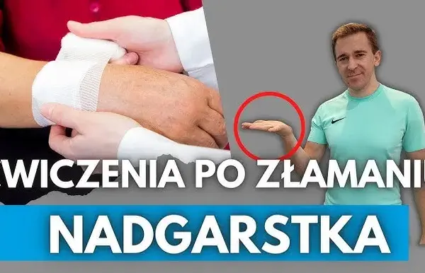 Ile trwa rehabilitacja po złamaniu nadgarstka? Poznaj szczegóły procesu