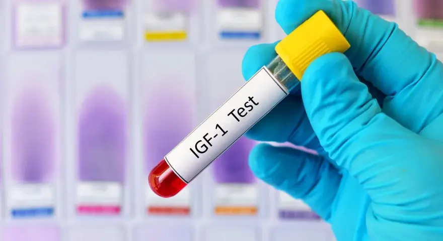 Ręka w niebieskiej rękawiczce trzyma probówkę z napisem "IGF-1 Test" na tle szkiełek laboratoryjnych.