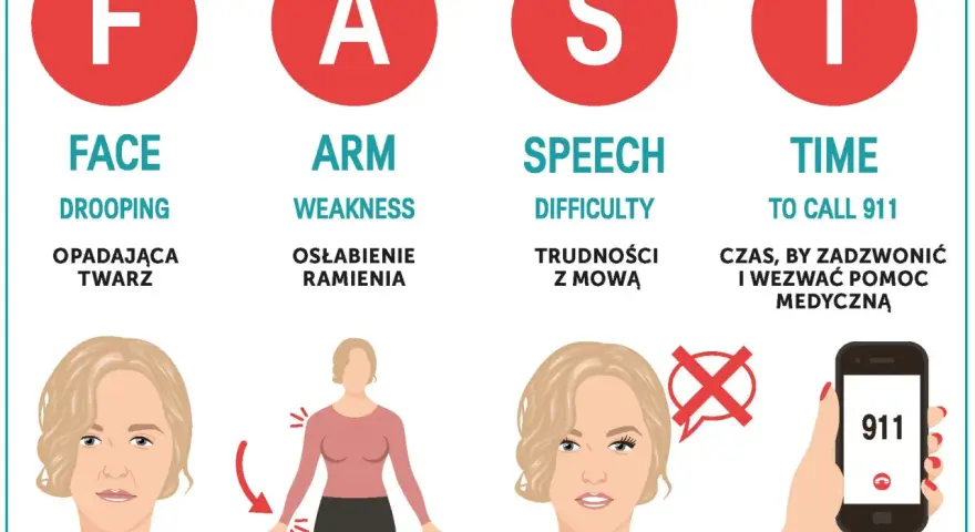Objawy wylewu u kobiet: opadająca twarz, osłabienie ramienia, trudności z mową. Czas to życie, dzwoń pod 911!