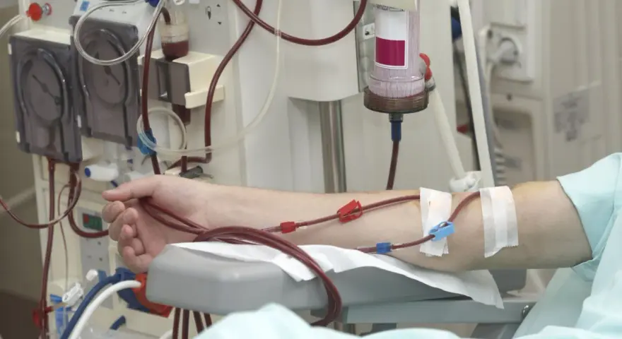 Ramię pacjenta podłączone do aparatury dializacyjnej.