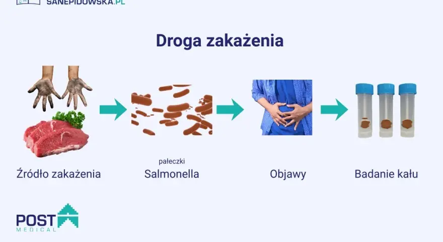 Droga zakażenia Salmonellą: od surowego mięsa i brudnych rąk, przez pałeczki, do objawów bólu brzucha i badania kału.