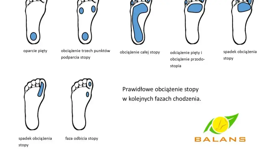Ilustracje pokazują prawidłowe obciążenie stopy w chodzeniu, od pięty po palce. Brak prawidłowego podparcia łuku stopy może prowadzić do płaskostopie.