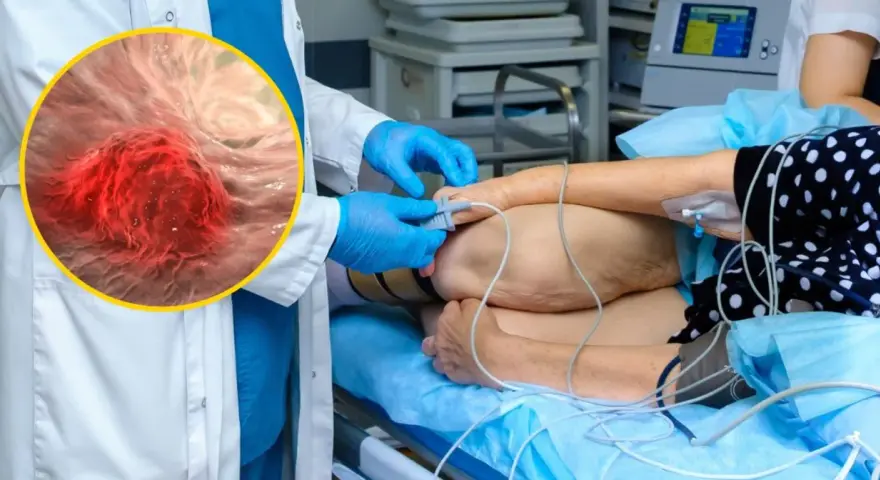 Lekarz w rękawiczkach przygotowuje pacjenta do zabiegu, ilustrując najnowsze metody leczenia raka jelita grubego. W powiększeniu widać komórki nowotworowe.