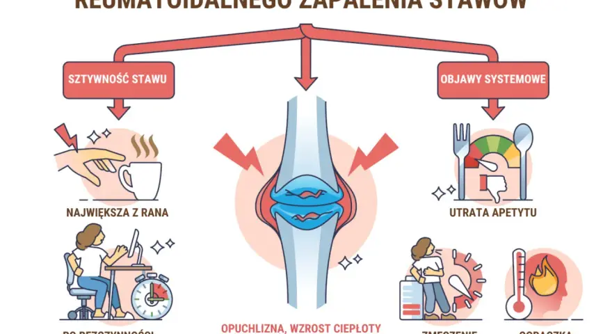 Ilustracja przedstawia schemat wczesnych oznak reumatoidalnego zapalenia stawów, z zaznaczonym stawem kolanowym i objawami.