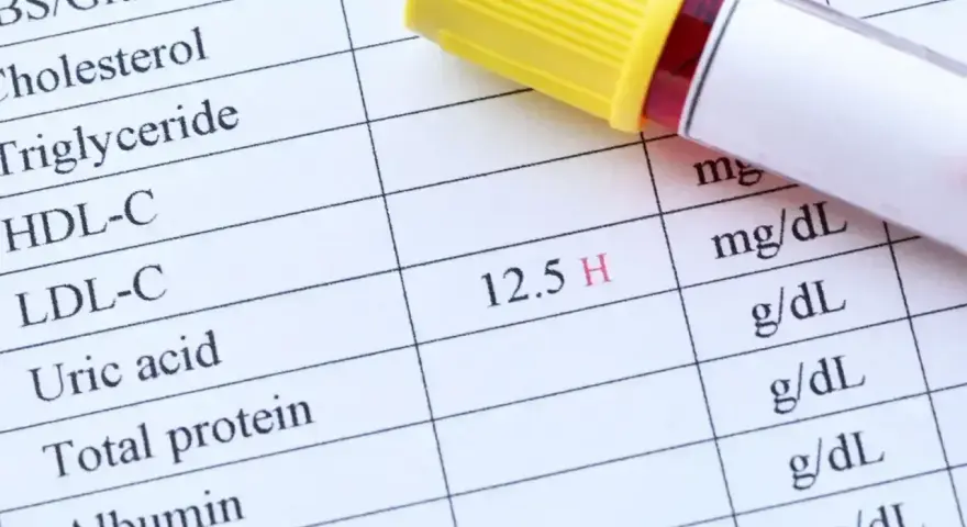 Wynik badania krwi, gdzie widoczny jest podwyższony poziom kwasu moczowego (12.5 H).