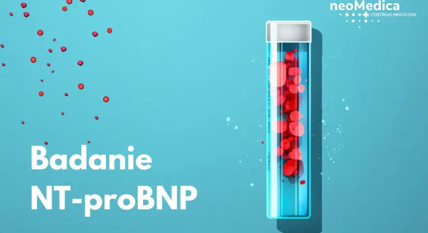 Probówka z czerwonymi próbkami i tekst "Badanie NT-proBNP" na niebieskim tle.