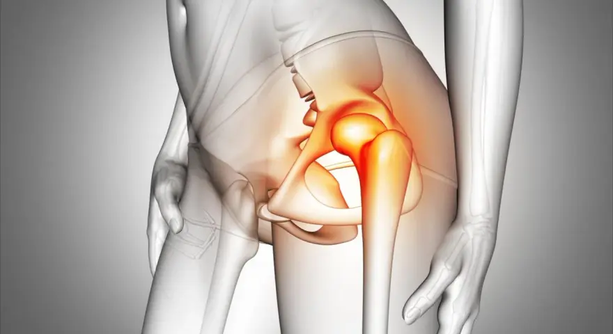 Anatomical illustration of a human pelvis with the hip joint highlighted in red, indicating pain.